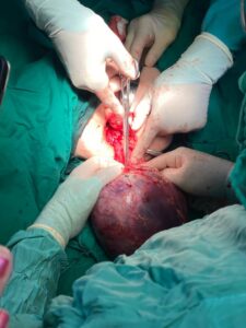 IMG-20260120-WA0006-225x300 Abner ya es un niño feliz